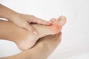 What You Should Know About Bunions